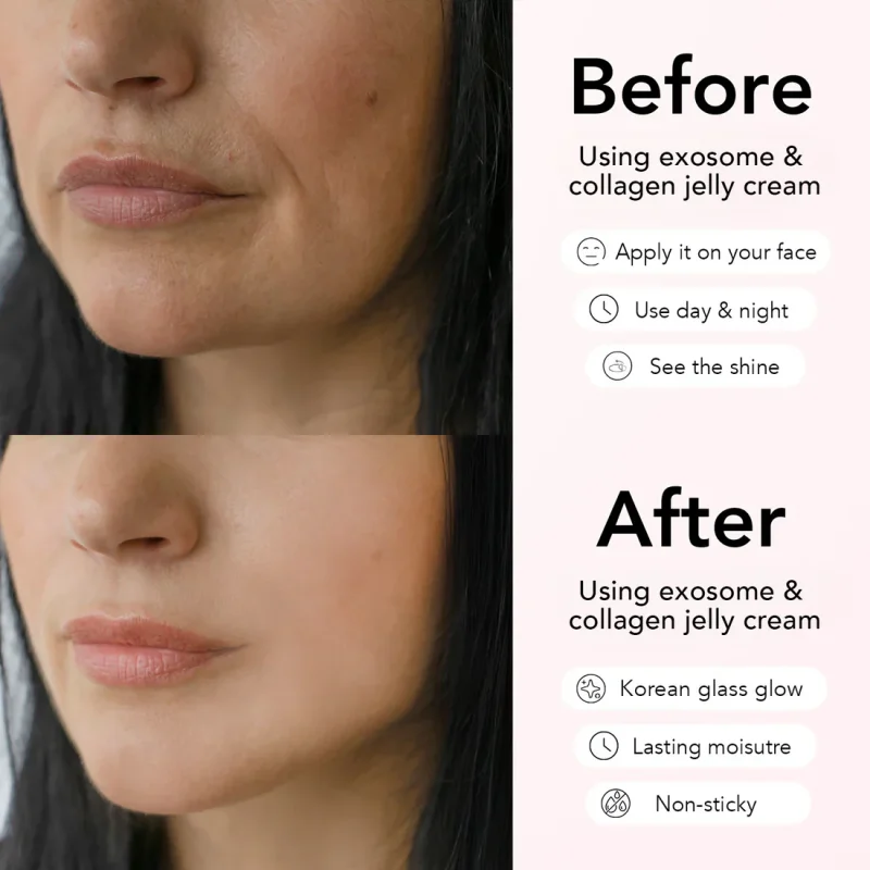 beforeafterjcream_99d7d4d3-7f08-43b2-bc83-db73bacf7413 Geleia de Colágeno Niacinamida + Máscara Grátis